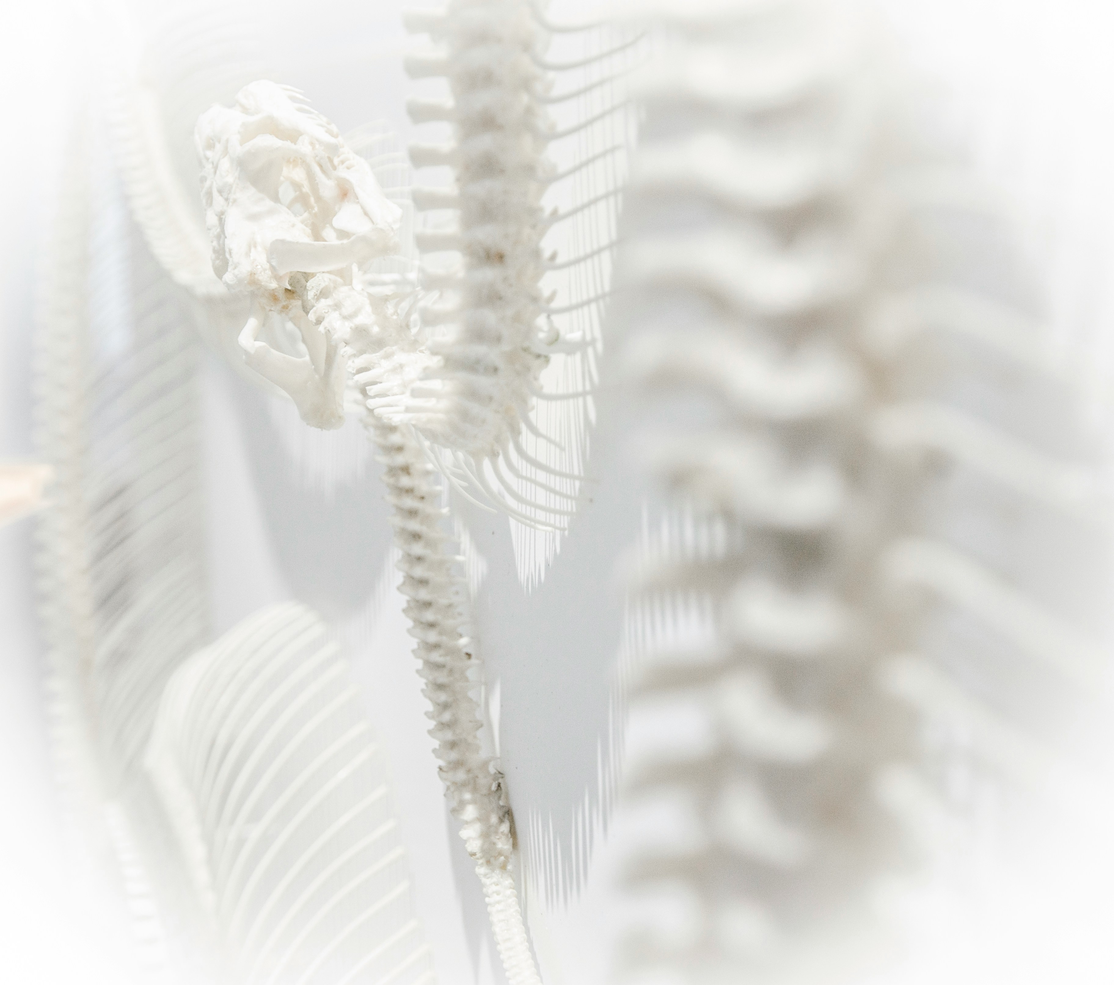 Chiropractor Walnut Creek CA — patient receiving non-surgical spinal decompression at a modern clinic on Ygnacio Valley Rd